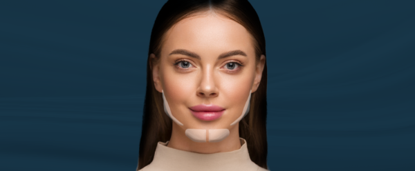 implantes faciais