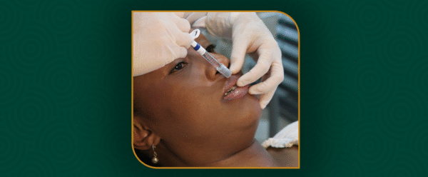 harmonização facial