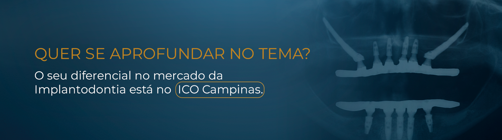 técnica all-on-four